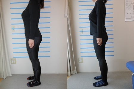 堺市 骨盤ダイエット 口コミで選ぶなら よしもと骨盤美容整体院